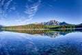 Canadian Landscape: Patricia Lake at Jasper National Park