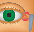 Canaliculitis. Inflammation of lacrimal canals. The structure of the eye. Infographics. Vector illustration. Royalty Free Stock Photo