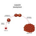 Cancer cell. illustration showing cancer disease development. Royalty Free Stock Photo