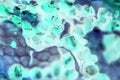 Cancer cells under the microscope. Tissues affected by cancer cells under a microscope, Science. Cancer medicine. chemistry and
