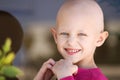 Cancer child Royalty Free Stock Photo