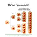 Cancer Development Royalty Free Stock Photo