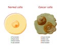 Cancer and normal cells. comparison and difference