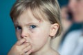 Candid serious thinking or sad young baby caucasian blonde girl with small scratch portrait at home Royalty Free Stock Photo