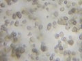 Candida albicans under the microscope Royalty Free Stock Photo