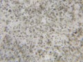 Candida albicans under the microscope Royalty Free Stock Photo