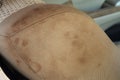 Car seats are stain caused by its use upholstery soiled stains