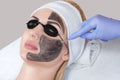 Carbon face peeling procedure in a beauty salon. Royalty Free Stock Photo