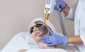 Carbon face peeling procedure in a beauty salon. Hardware cosmetology treatmen