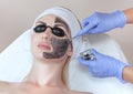 Carbon face peeling procedure in a beauty salon. Hardware cosmetology Royalty Free Stock Photo