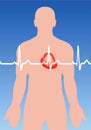 Cardiac arrhythmia Royalty Free Stock Photo