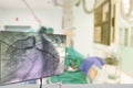 Cardiac Catheterization with Coronary Angiography on blurry Angiography Room Cardiac Catherization Lab Room
