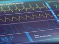 Cardiac frequency closeup