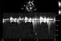 Cardiac ultrasound images . Doppler echo