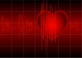 The cardiogram