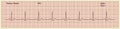 Cardiogram