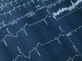 Cardiogram Royalty Free Stock Photo