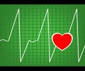 Cardiogram