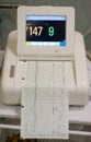 Cardiogram