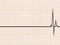 Cardiogram