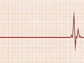 Cardiogram