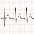 Cardiogram. Electrocardiogram. Graphic representation of heart work . Health and medicine.