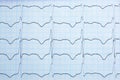 Cardiogram graph paper background