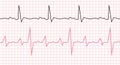 Cardiogram on a graph paper. Heartbeat line. Vector illustration