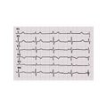 Cardiogram. Heartbeat. The graph on graph paper. Vector illustration on isolated background Royalty Free Stock Photo