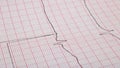 Cardiogram line close up, heart diseases, macro photo