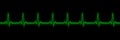 Cardiogram oscilloscope blue color