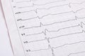 Cardiogram results on white paper, heart health