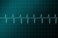 Cardiogram ritm illustration.