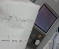Cardiograph shows fetal heart rate