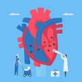 Cardiology vector illustration. This disease calls endocarditis. It is infection of endocardium that is inner heart chambers and