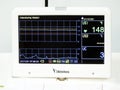 Cardiotocography device placed on mother\'s abdomen recording the fetal heart rate obtained via ultrasound transducer