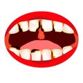 Caries. Smell from the mouth. Halitosis. The structure of the teeth and oral cavity. Diseases of the teeth caries