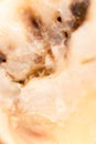 Caries in the tooth. macro