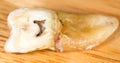 Caries in the tooth. macro