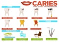 Caries types stages and prevention poster with text vector Royalty Free Stock Photo