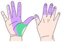 Carpal Tunnel Syndrome median nerve