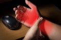 Carpal tunnel syndrome,wrist pain