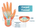 Carpal tunnel vector illustration scheme. Medical labeled diagram closeup with transverse carpal ligament and median nerve. Royalty Free Stock Photo