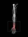 Carpal Tunnel Wrist Pain Royalty Free Stock Photo