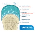 Cartilage vector illustration. Scheme of chondrocytes, collagen fibers, calcified, subchondral cancellous bone and superficial.