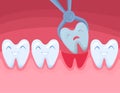 Cartoon Color Character Tooth is Removed. Vector