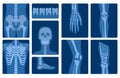 Cartoon Color Xray Shots Human Skeleton Body Parts Set. Vector Royalty Free Stock Photo