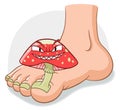 Cartoon foot and nail fungus