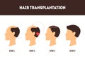 Cartoon Hair Transplant Surgery Card Poster. Vector