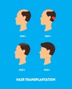 Cartoon Hair Transplant Surgery Card Poster. Vector Royalty Free Stock Photo